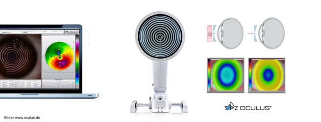 oculus_keratograph5m_koeln